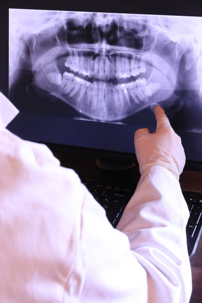 Best Urgent Care for Lost Fillings or Crowns in Friars Point, MS